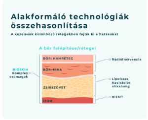 kavitációs ultrahang, lipolaser, rádiófrekvencia, hiemt