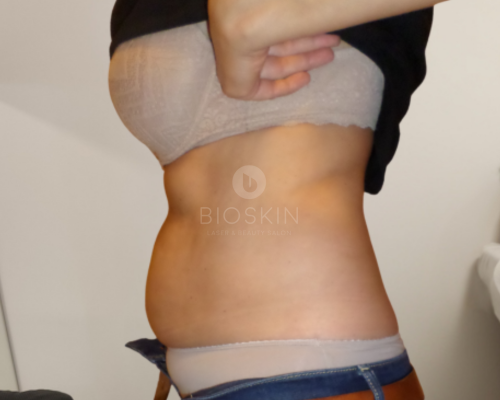 Before image
