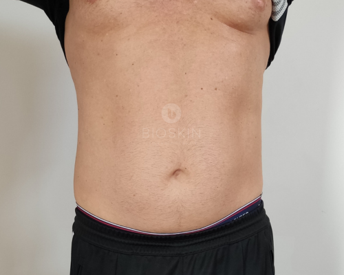 After image