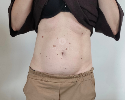 After image