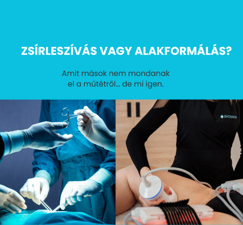 zsirleszivas helyett kavitacio