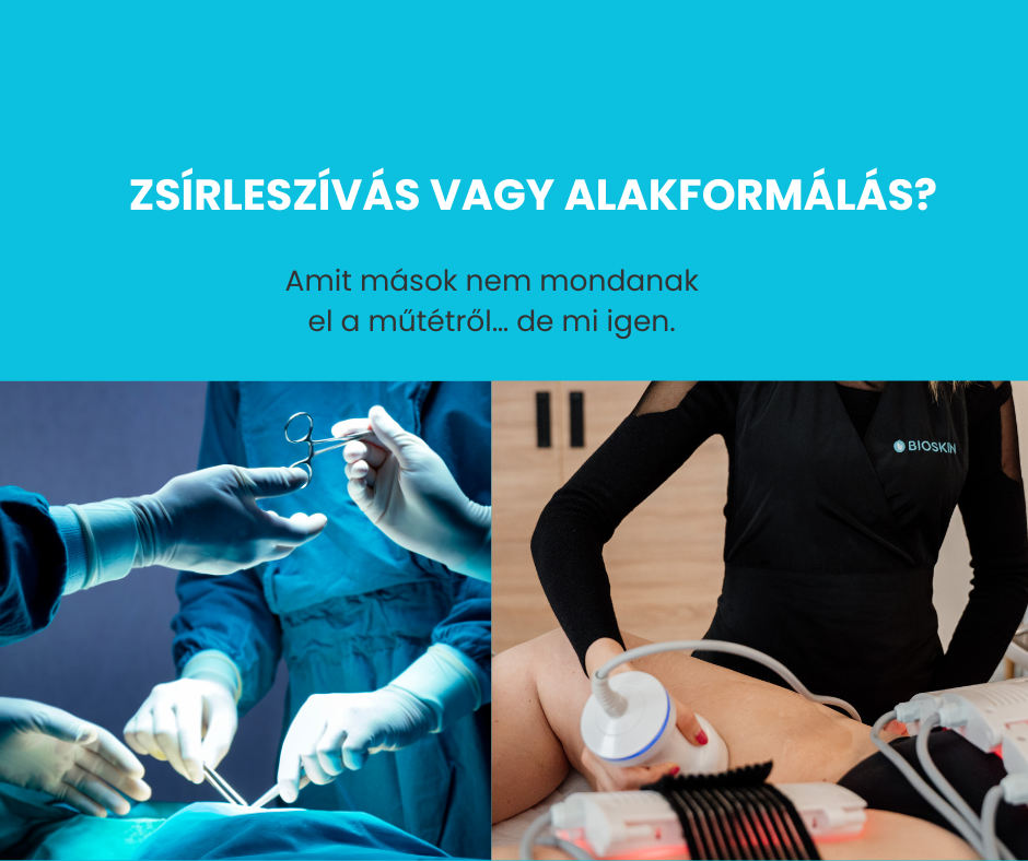 zsirleszivas helyett kavitacio